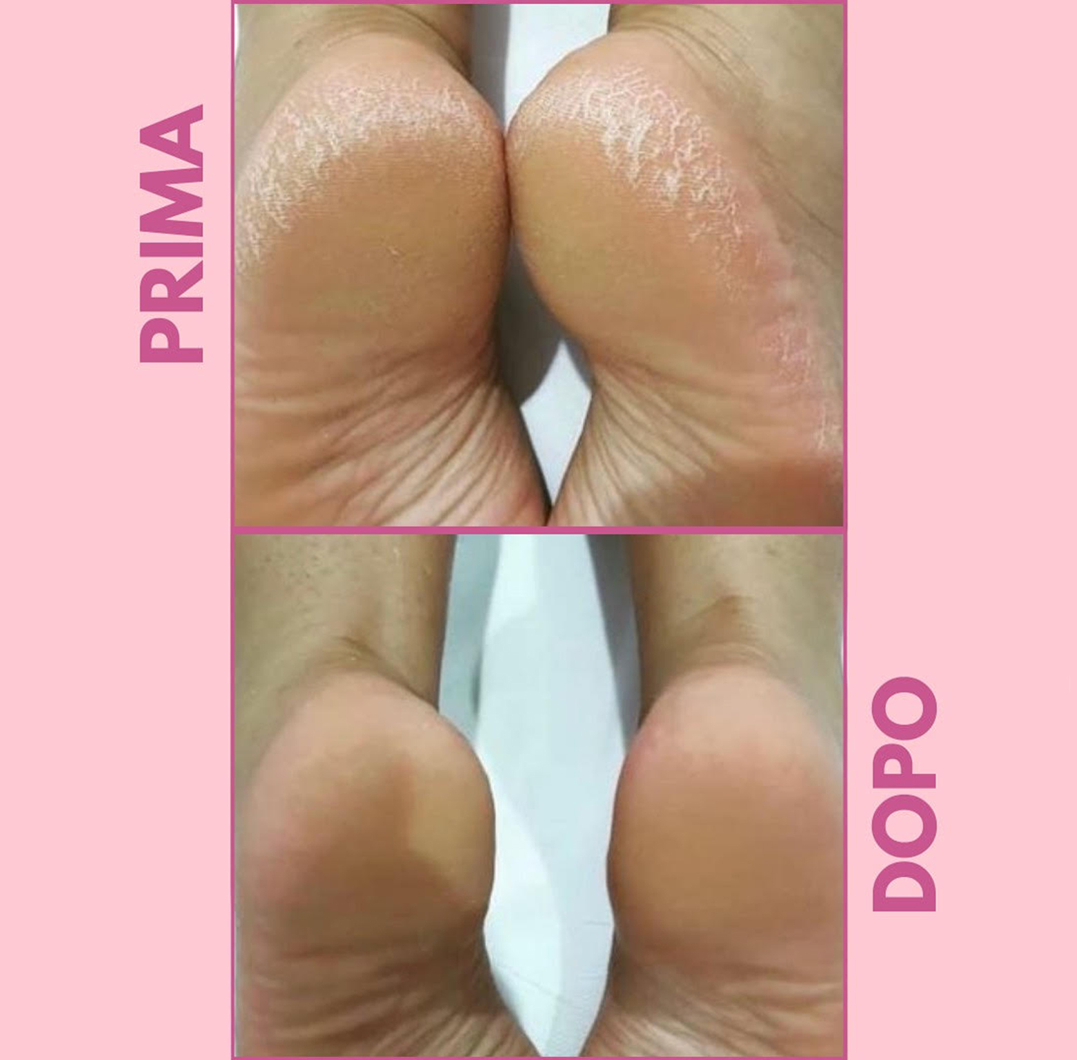 yumi feet img 02